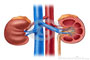 Aumento dos casos de insuficiência renal preocupa
